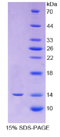 细胞程序性死亡蛋白1(PDCD1)重组蛋白