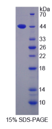双解丝蛋白1(TWF1)重组蛋白