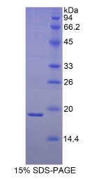 热休克蛋白β3(HSPβ3)重组蛋白