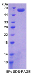 集聚蛋白(AGRN)重组蛋白