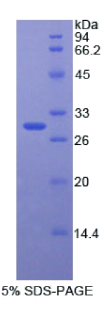 连环蛋白β1(CTNNβ1)重组蛋白