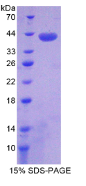 序列相似家族135成员B(FAM135B)重组蛋白