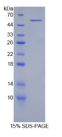 整合素β2(ITGβ2)重组蛋白