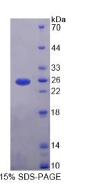 含CUB域蛋白1(CDCP1)重组蛋白