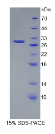 含卷曲螺旋域蛋白3(CCDC3)重组蛋白