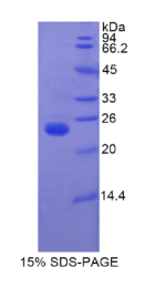 胰岛素样生长因子结合蛋白6(IGFBP6)重组蛋白