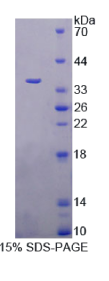 含三核苷酸重复序列蛋白6A(TNRC6A)重组蛋白