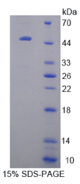 晶状体蛋白βB1(CRYβB1)重组蛋白