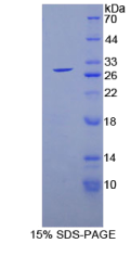 谷胱甘肽S转移酶α1(GSTα1)重组蛋白