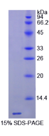 胸腺素β4(Tβ4)重组蛋白