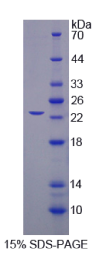 剪接因子3B亚基3(SF3B3)重组蛋白