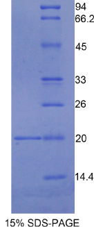 胰腺特异转录因子1α(PTF1α)重组蛋白