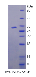 含F-框WD重复域蛋白7(FBXW7)重组蛋白