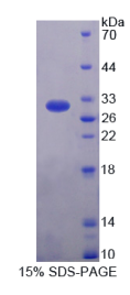 亨廷顿相互作用蛋白12(HIP12)重组蛋白