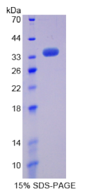 同线蛋白2(ST2)重组蛋白