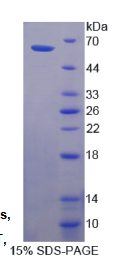 角化粒素(CDSN)重组蛋白