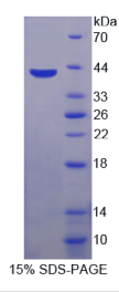 巨噬细胞炎性蛋白1β(MIP1β)重组蛋白