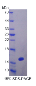 含密封蛋白/ELL域蛋白1(OCEL1)重组蛋白