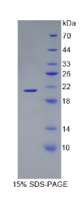 血红蛋白α1(HBα1)重组蛋白