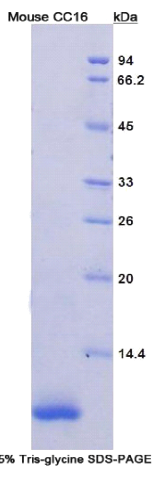 克拉拉细胞蛋白16(CC16)重组蛋白