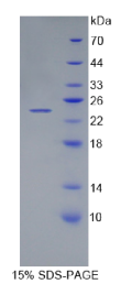 肌肽酶1(CNDP1)重组蛋白