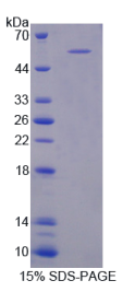含普列克底物同源物域家族A成员1(PLEKHA1)重组蛋白