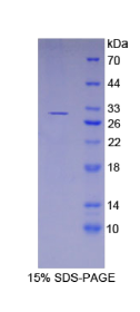 谷胱甘肽S转移酶μ3(GSTμ3)重组蛋白