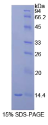 巨噬细胞炎性蛋白1γ(MIP1γ)重组蛋白