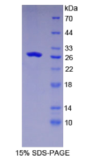 谷胱甘肽S转移酶κ1(GSTκ1)重组蛋白