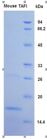纤溶抑制因子(TAFI)重组蛋白