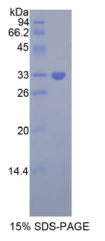 生长因子受体结合蛋白7(Grb7)重组蛋白