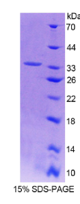 辅肌动蛋白α3(ACTN3)重组蛋白