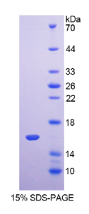跨膜蛋白27(TMEM27)重组蛋白