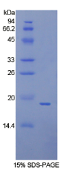 膜联蛋白A4(ANXA4)重组蛋白