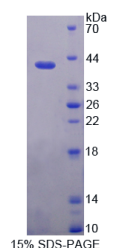 角蛋白6C(KRT6C)重组蛋白