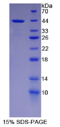 核因子κB2(NFκB2)重组蛋白