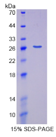 蜗管蛋白(COIL)重组蛋白