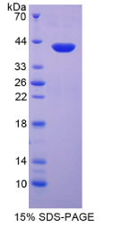 巨噬细胞炎性蛋白1α(MIP1α)重组蛋白