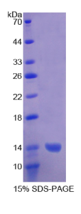 血小板反应蛋白解整合素金属肽酶1(ADAMTS1)重组蛋白