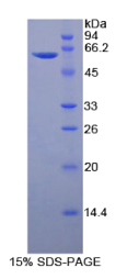 血小板反应蛋白4(THBS4)重组蛋白