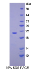 血管细胞粘附分子1(VCAM1)重组蛋白