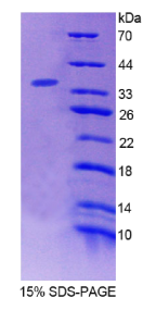 桥连整合因子2(BIN2)重组蛋白