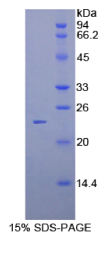 原钙黏素β2(PCDHβ2)重组蛋白