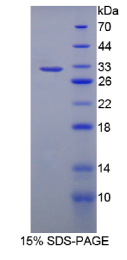 含亮氨酸丰富重复蛋白32(LRRC32)重组蛋白