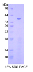 细胞绒毛蛋白(CVL)重组蛋白