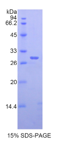 解整合素金属蛋白酶6(ADAM6)重组蛋白