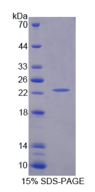 胱天蛋白酶1(CASP1)重组蛋白