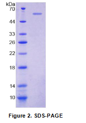 跨膜4域亚家族A成员1(MS4A1)重组蛋白