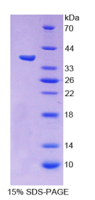 原钙黏素β15(PCDHβ15)重组蛋白