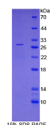 脊髓灰质炎病毒受体相关分子2(PVRL2)重组蛋白